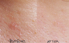 Load image into Gallery viewer, Exuviance Empower Anti-Redness Calming serum
